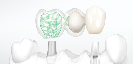 CAD-CAM технологии зубы